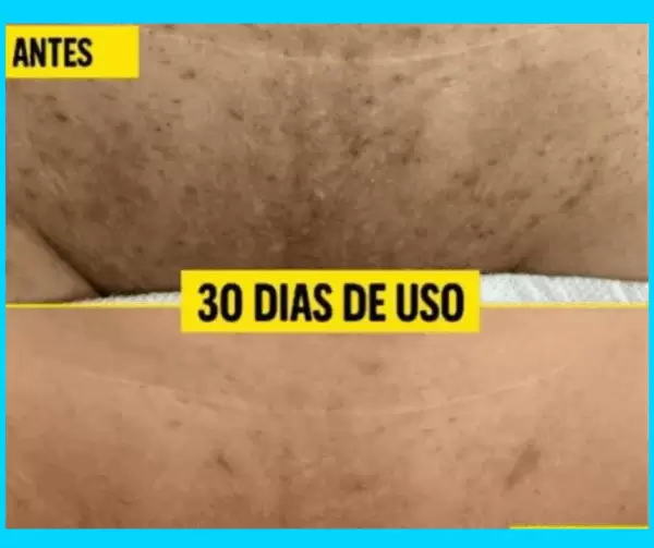 Cliente Amazolé Lívia F.