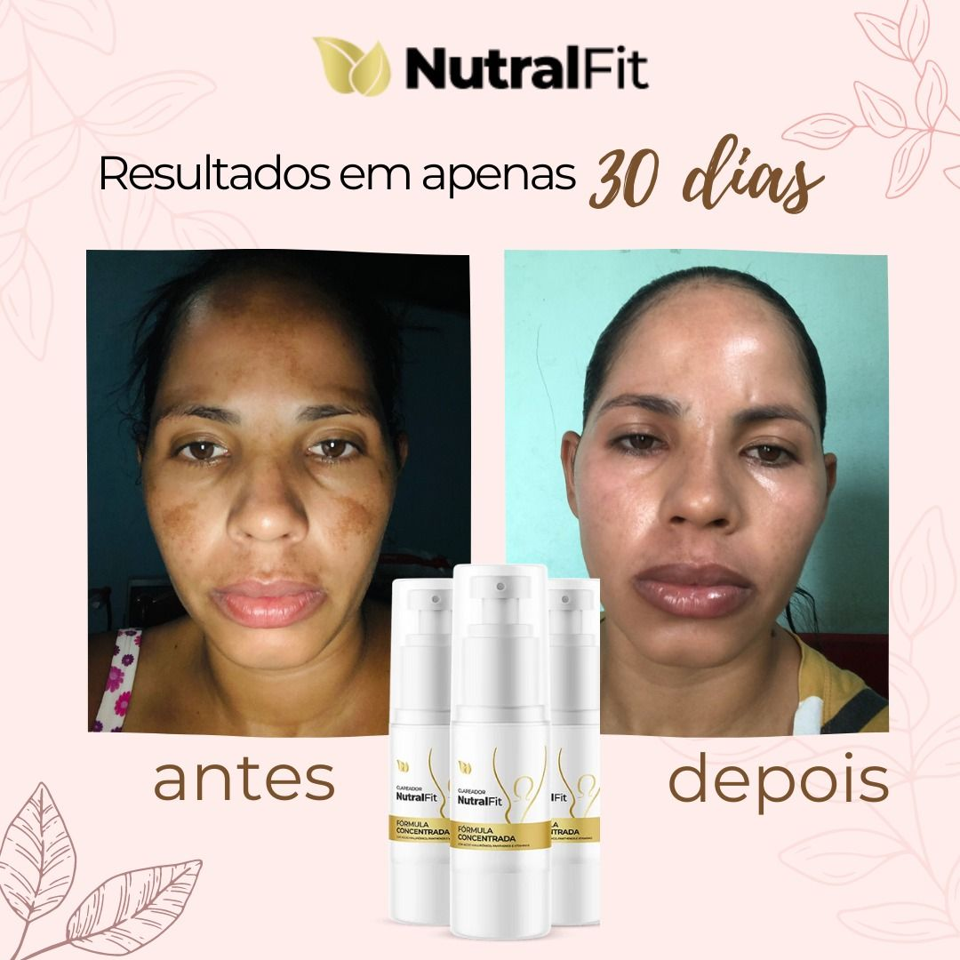 NutralFit Clareador em uso ou resultado
